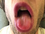 You Are All My Burp Bitches