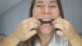 Look at my mouth and teeth so close a