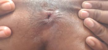 Ass Big Black Hole in Fingering Fake Indian Man