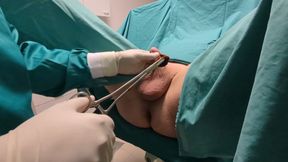 Prostata surgery part 2