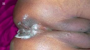 Step son fucked  his step-mommy,s ass hole open and orgajom in ass hole.