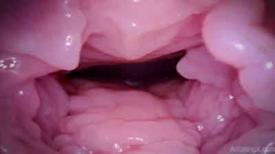 **** Immersion, Pulsing Cervix - 1080P