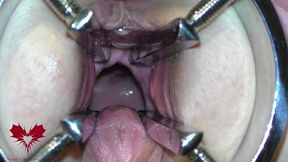 the mistress  cunt is opened with a hole expander so that you can study her cervix.