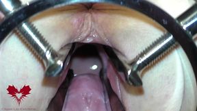 the mistress  cunt is opened with a hole expander so that you can study her cervix.