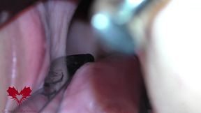 the mistress  cunt is opened with a hole expander so that you can study her cervix.