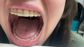 Climb into cute giantess's retainer mouth