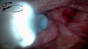 Exclusive: Camera Goes Inside � We Found My G-Spot and Captured 5 Orgasms!