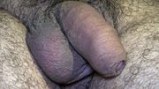My Balls Dropped and Tight Sack