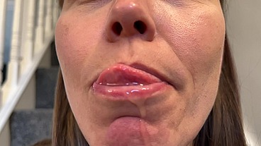 Tongue Saliva