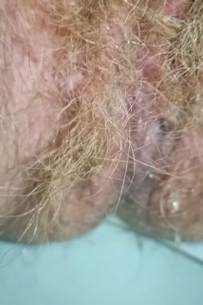 Compilation of Pissing and Farting Video at Different Periods of a Shameless Hairy Milf Nextdoor