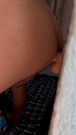 Orgasmo prostatico
