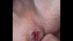 My swollen sphincter after fisting resembles a pussy