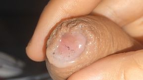 Curious Close-up of Pre-cum in Flaccid Phimosis.