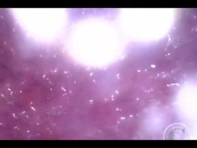 Inflating My Bladder with Air!