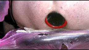 huge anal toys and prolapse