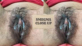 My hairy pussy and smegma