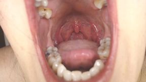 Throat and Mouth Spit Strings Uvula Tonsils Uvula