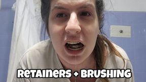 Braces Retainer, Saliva Play and Mouth Pain – Struggling to Talk, Spit Drips, Teeth Cleaning with Drool