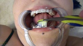 Dentist Probes Naughty Girl&#039;s Mouth