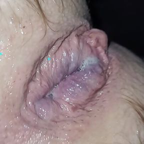 Small prolapse