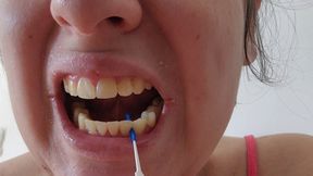 Satisfying Interdental Adventure: Getting Up Close with Every Tooth