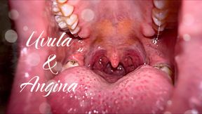 Watching Your Uvula While You are Sick A Deep Fascination