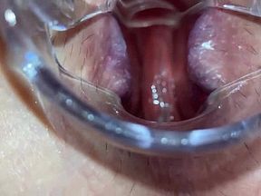 A look inside