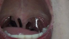 Super Spectacle Swallowing Big Spiders!