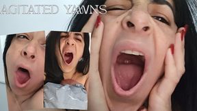 Lethargic yawns