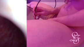 endoscope pov inflated bladder - pissing in the bathub