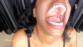 I&#039;m ready for my mouth exam, custom