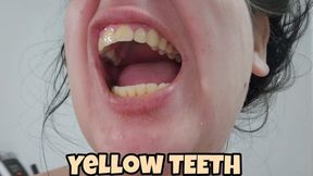 Brushing My Yellow croocked and Dirty Teeth After 7 Days – Real Oral Hygiene With Close-Ups and Spit