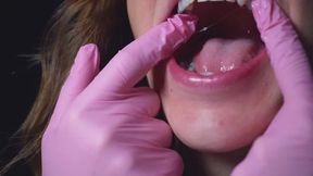 POV: Dental Exam II – 10 Minutes Silver Fillings