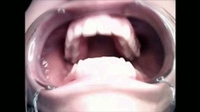 Mouth tour endoscopy wmv