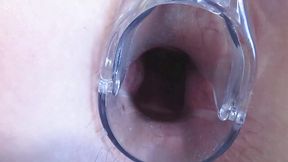 MILF With a Fat Ass Gets Her Shitters Stretched Wide Open With a Gyno Speculum, Gaping Asshole and Pussy on Display