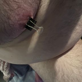 Nipple clamps removed after thirty minutes and more clamps added