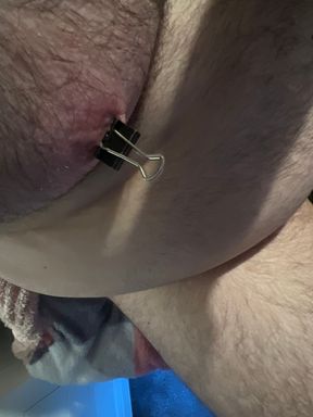 Nipple clamps removed after thirty minutes and more clamps added