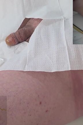 16 French Foley Insertion