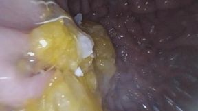 Endoscopic Exploration of a Mandarin Orange (part 2)