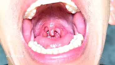 Uvula in the foreground - Collection 12