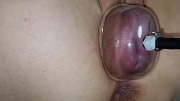 Using a pussy pump to swell my pussy lips and my swollen vagina