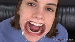 Inside My Mouth - Hellen - Mouth retractor clip! (FULLHD quality)