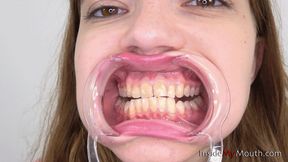 Inside My Mouth - Lola - Mouth retractor clip! (HD quality)