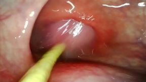 Ultra Rough Anal&#x1F44C; DP: Deep Camera Vantage as Big Dick&#x1F346; Bursts with Intense Cumshot