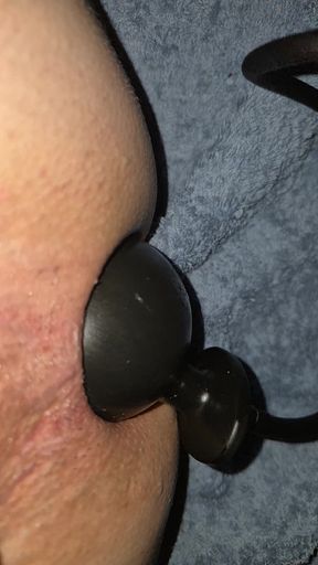 Anal dilation