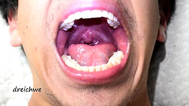 Deep uvula