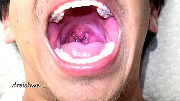 Deep uvula