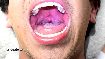Deep uvula