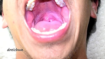 Deep uvula