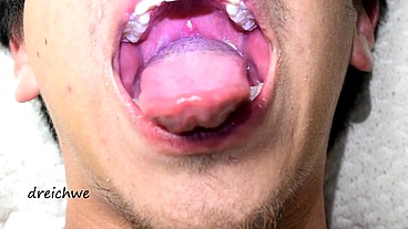 Deep uvula